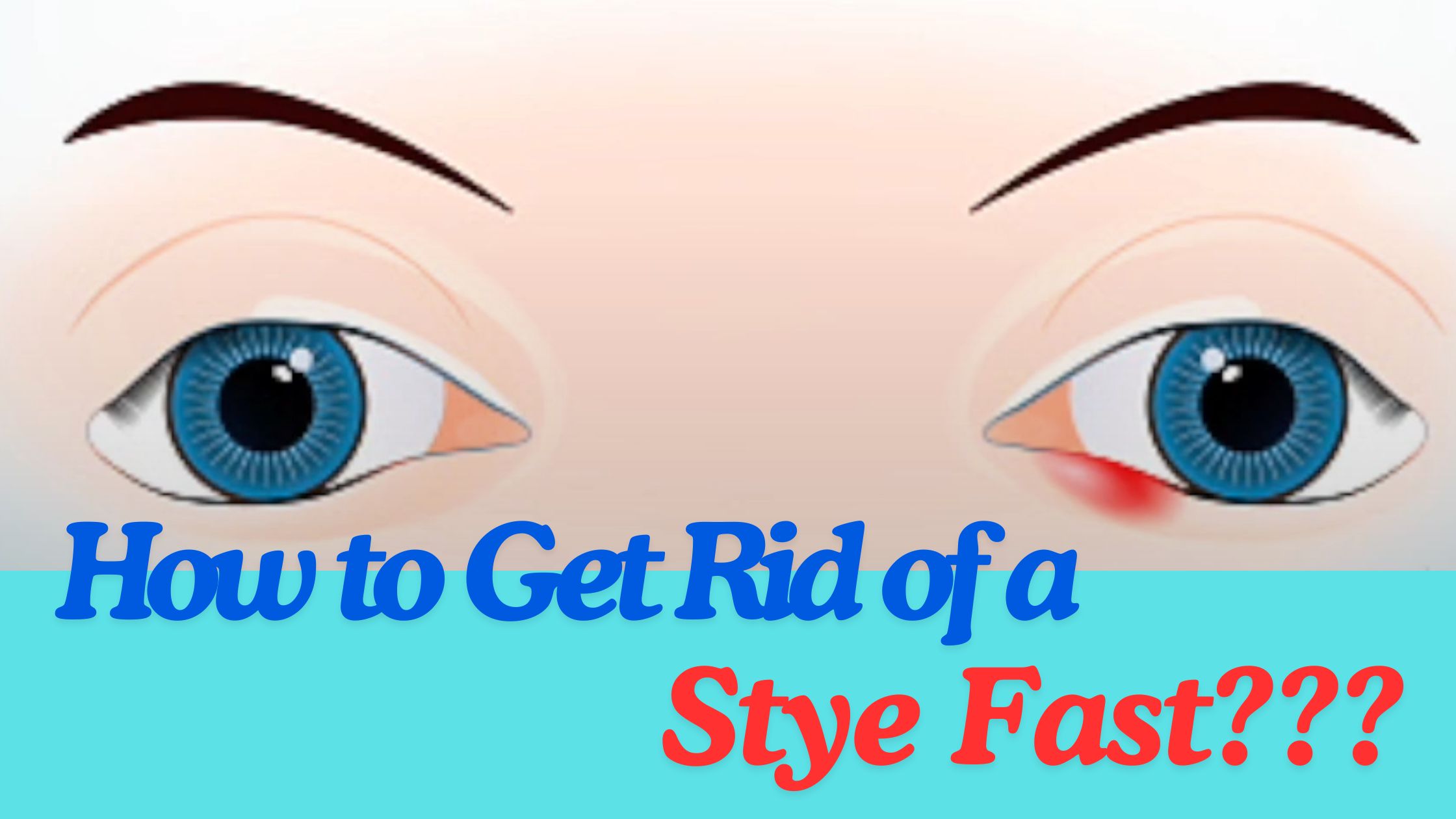 Read more about the article How to Get Rid of a Stye Fast: Effective Remedies and Expert Tips