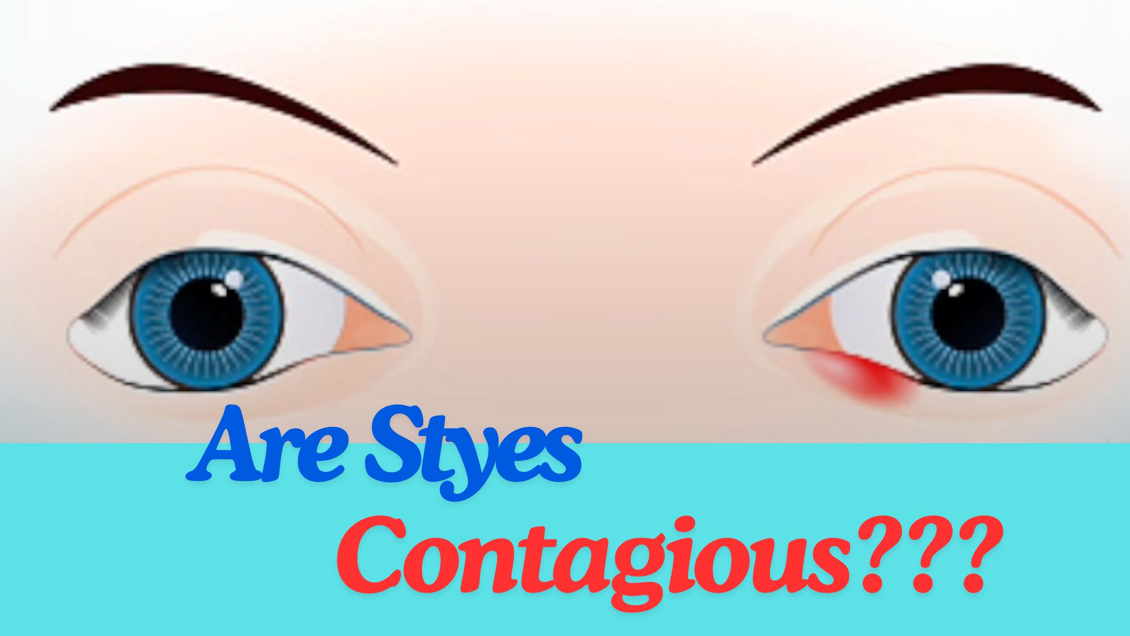 Read more about the article Are Styes Contagious? Expert Insights into Causes, Spread, and Effective Remedies