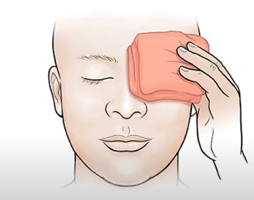 Warm compresses for the treatment of stye. the cloth should be hygienic and clean